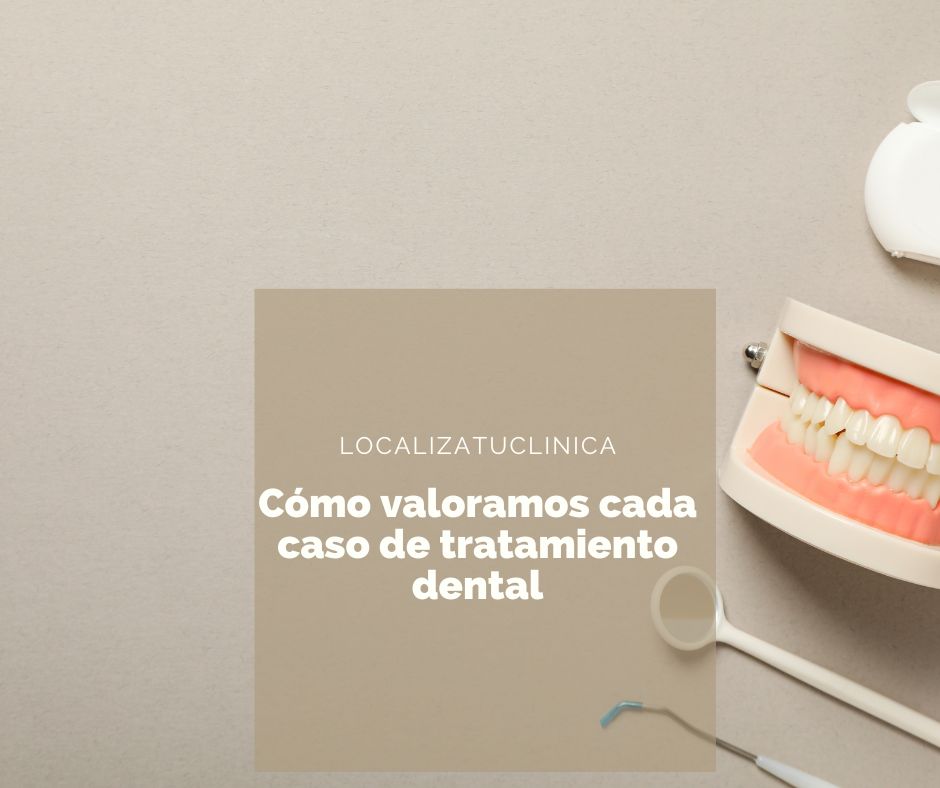 Como valoramos cada caso antes de proponer un tratamiento dental
